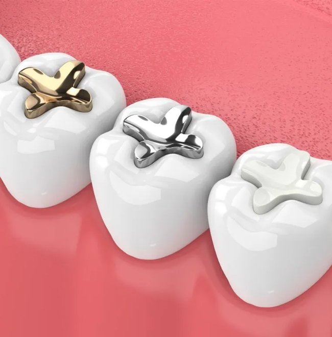 Dental Filling Metuchen - House of Dentistry